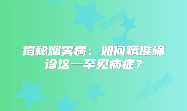 揭秘烟雾病：如何精准确诊这一罕见病症？