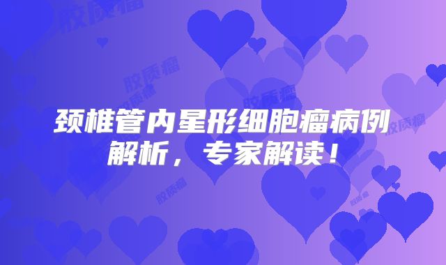 颈椎管内星形细胞瘤病例解析，专家解读！