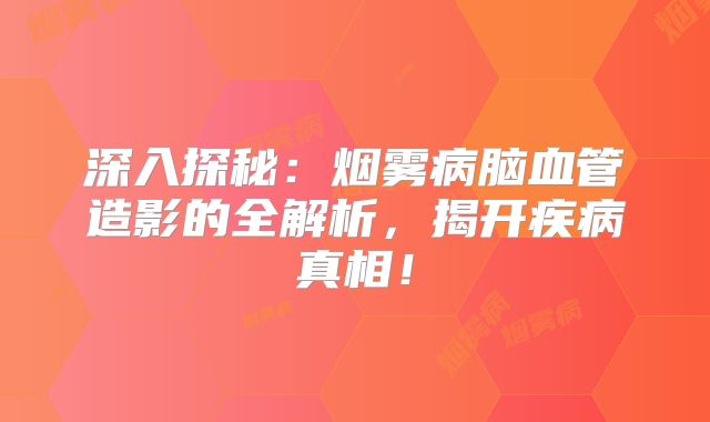 深入探秘：烟雾病脑血管造影的全解析，揭开疾病真相！