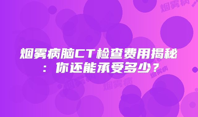 烟雾病脑CT检查费用揭秘：你还能承受多少？