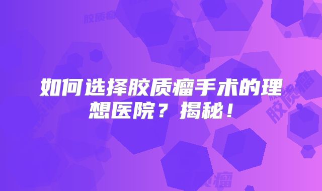 如何选择胶质瘤手术的理想医院？揭秘！