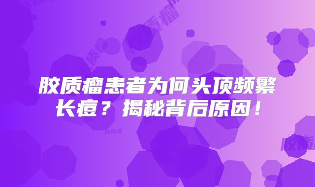 胶质瘤患者为何头顶频繁长痘？揭秘背后原因！