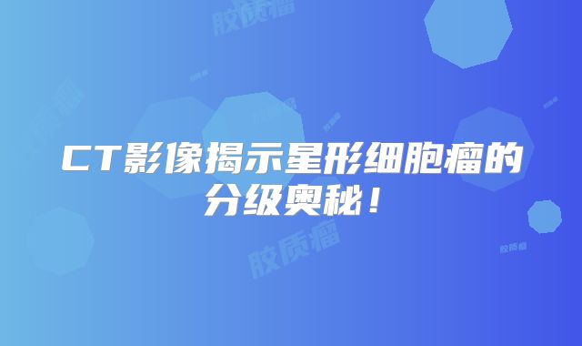 CT影像揭示星形细胞瘤的分级奥秘！