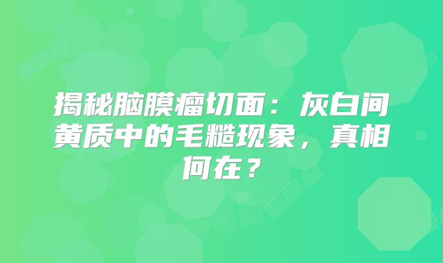 揭秘脑膜瘤切面：灰白间黄质中的毛糙现象，真相何在？