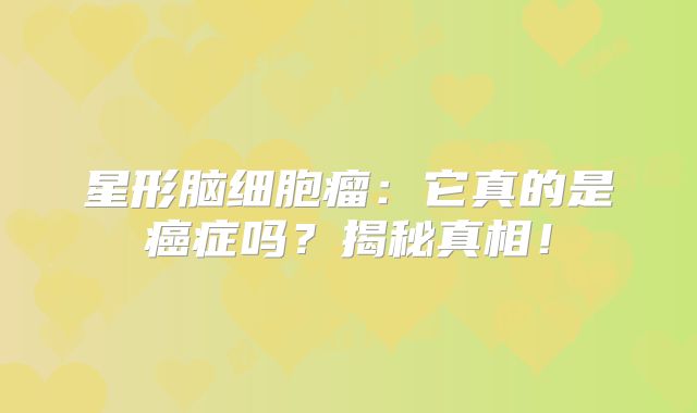 星形脑细胞瘤：它真的是癌症吗？揭秘真相！