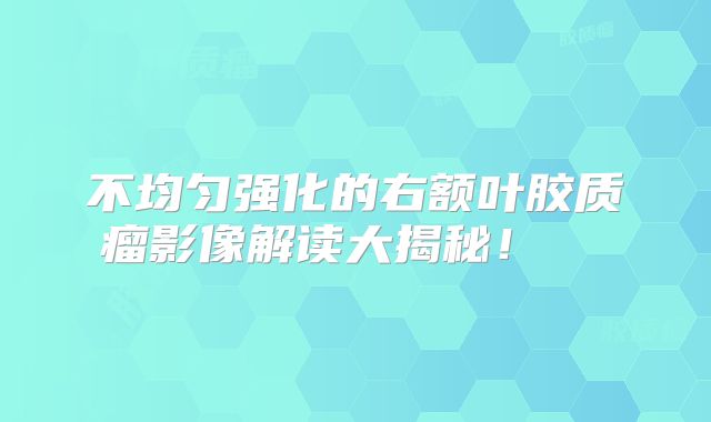 不均匀强化的右额叶胶质瘤影像解读大揭秘！  