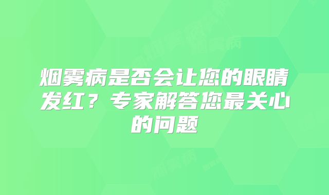 烟雾病是否会让您的眼睛发红？专家解答您最关心的问题