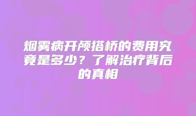 烟雾病开颅搭桥的费用究竟是多少？了解治疗背后的真相