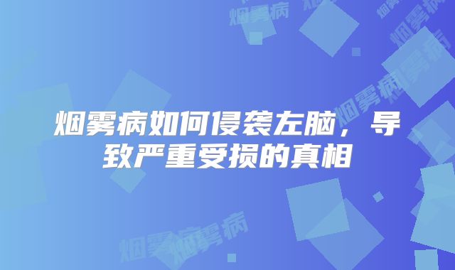 烟雾病如何侵袭左脑，导致严重受损的真相