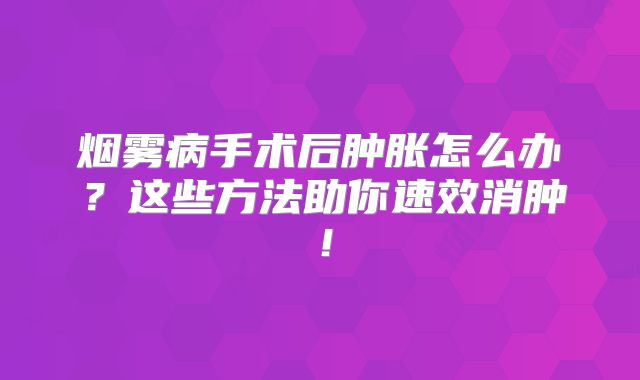 烟雾病手术后肿胀怎么办？这些方法助你速效消肿！