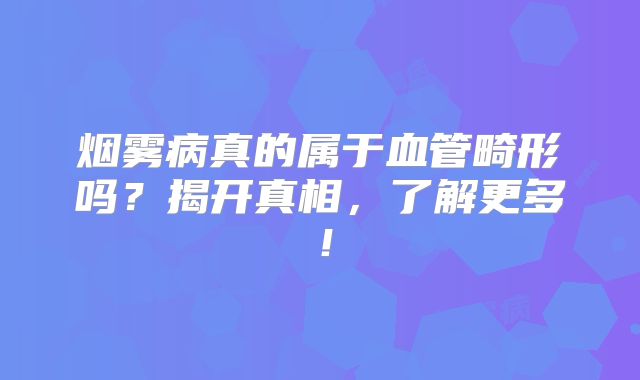 烟雾病真的属于血管畸形吗？揭开真相，了解更多！