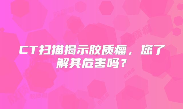 CT扫描揭示胶质瘤，您了解其危害吗？