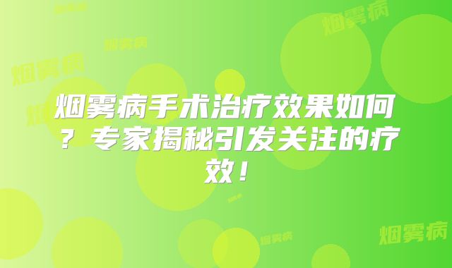 烟雾病手术治疗效果如何？专家揭秘引发关注的疗效！