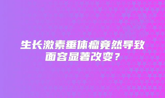 生长激素垂体瘤竟然导致面容显著改变？