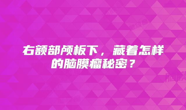 右额部颅板下，藏着怎样的脑膜瘤秘密？