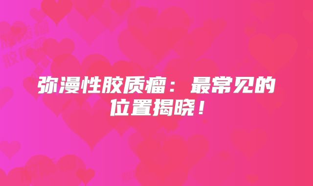 弥漫性胶质瘤：最常见的位置揭晓！