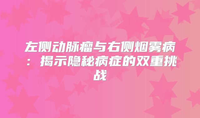 左侧动脉瘤与右侧烟雾病：揭示隐秘病症的双重挑战