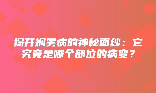 揭开烟雾病的神秘面纱：它究竟是哪个部位的病变？