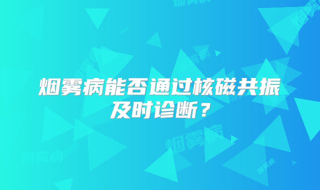 烟雾病能否通过核磁共振及时诊断？