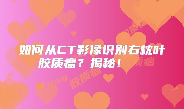 如何从CT影像识别右枕叶胶质瘤？揭秘！  