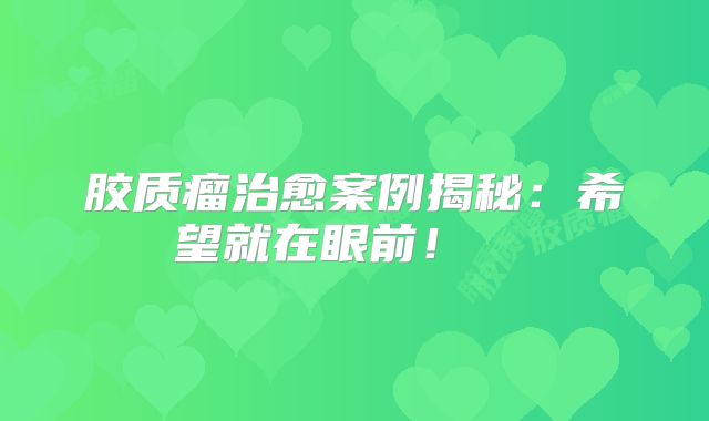 胶质瘤治愈案例揭秘：希望就在眼前！  