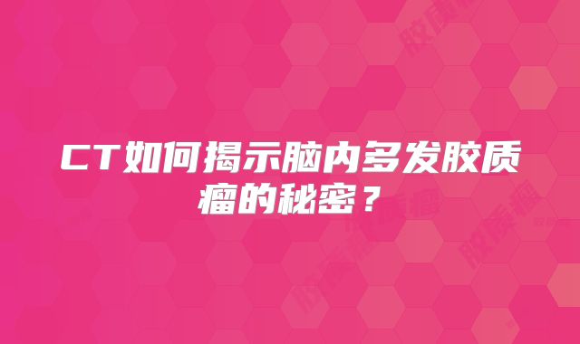 CT如何揭示脑内多发胶质瘤的秘密？