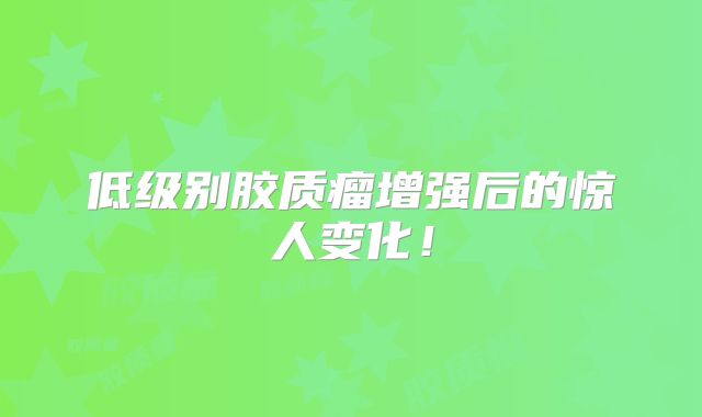 低级别胶质瘤增强后的惊人变化！