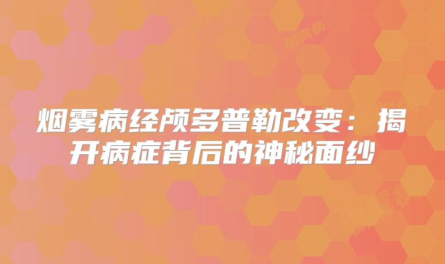 烟雾病经颅多普勒改变：揭开病症背后的神秘面纱