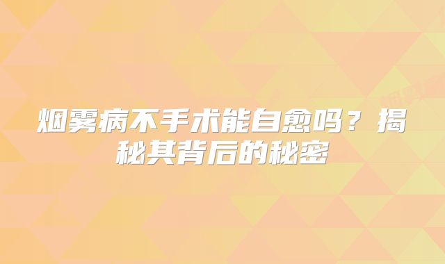 烟雾病不手术能自愈吗？揭秘其背后的秘密
