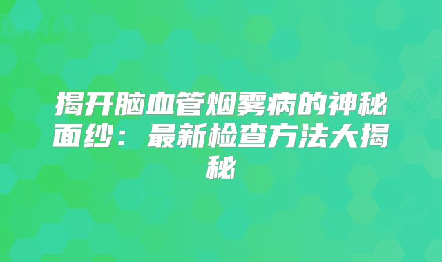 揭开脑血管烟雾病的神秘面纱：最新检查方法大揭秘