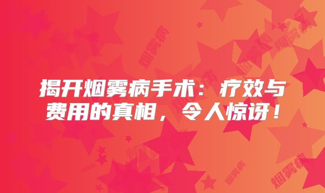 揭开烟雾病手术：疗效与费用的真相，令人惊讶！