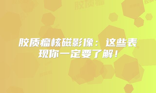 胶质瘤核磁影像：这些表现你一定要了解！