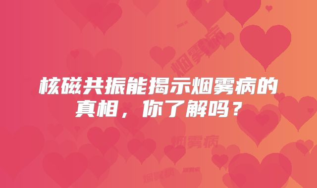 核磁共振能揭示烟雾病的真相，你了解吗？