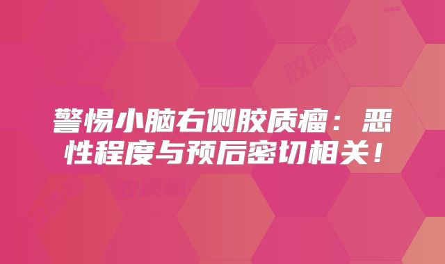 警惕小脑右侧胶质瘤：恶性程度与预后密切相关！
