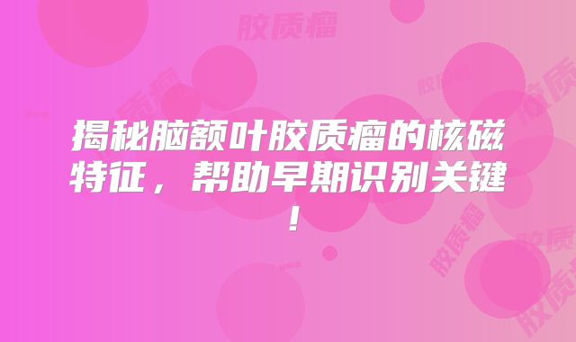 揭秘脑额叶胶质瘤的核磁特征，帮助早期识别关键！