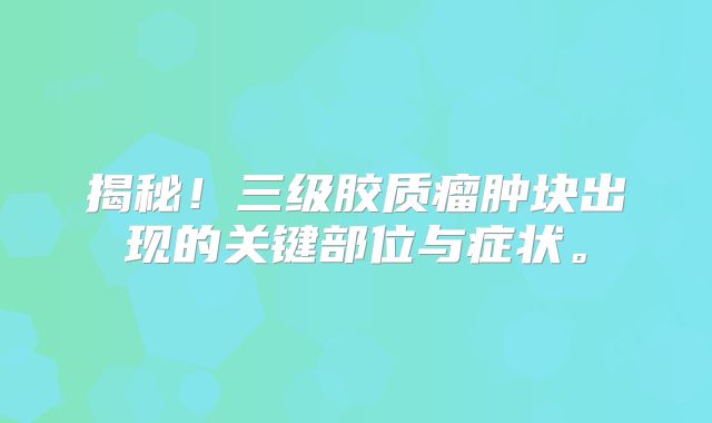 揭秘！三级胶质瘤肿块出现的关键部位与症状。