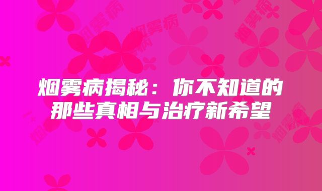 烟雾病揭秘：你不知道的那些真相与治疗新希望