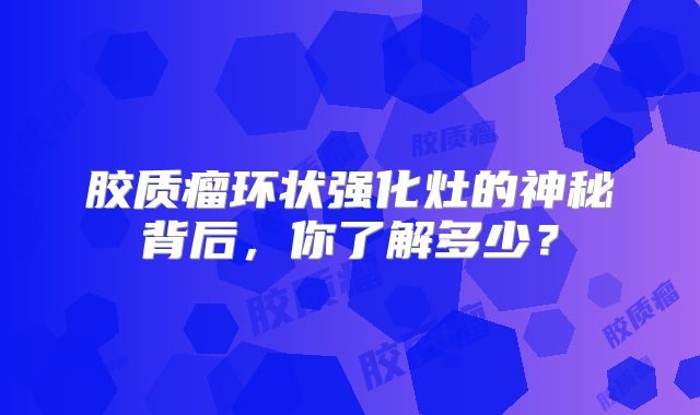胶质瘤环状强化灶的神秘背后，你了解多少？