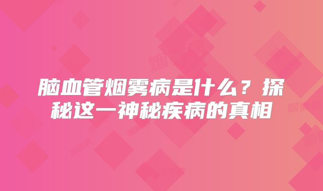 脑血管烟雾病是什么？探秘这一神秘疾病的真相