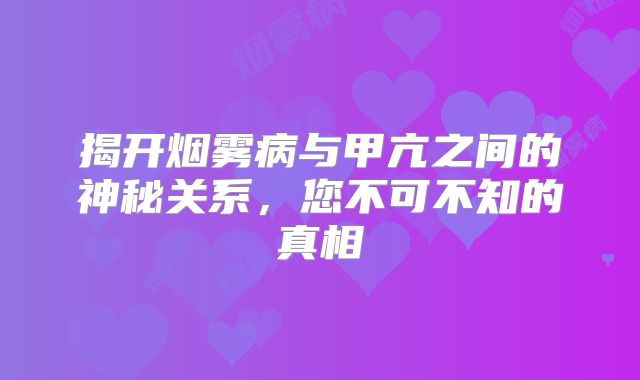 揭开烟雾病与甲亢之间的神秘关系，您不可不知的真相