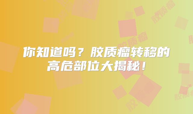 你知道吗？胶质瘤转移的高危部位大揭秘！