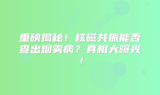 重磅揭秘！核磁共振能否查出烟雾病？真相大曝光！