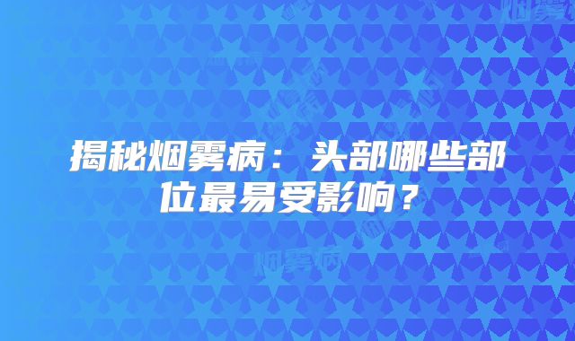 揭秘烟雾病：头部哪些部位最易受影响？