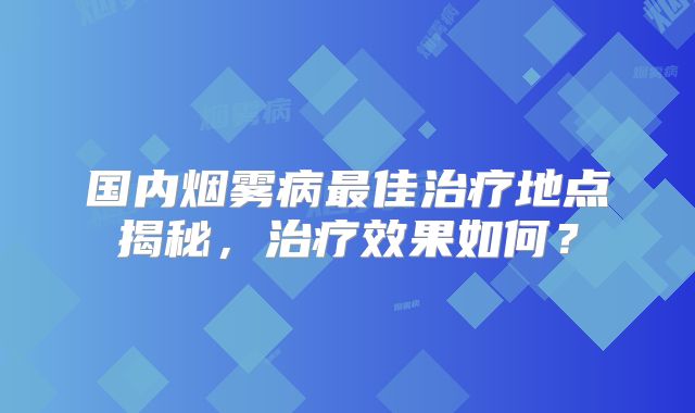 国内烟雾病最佳治疗地点揭秘，治疗效果如何？