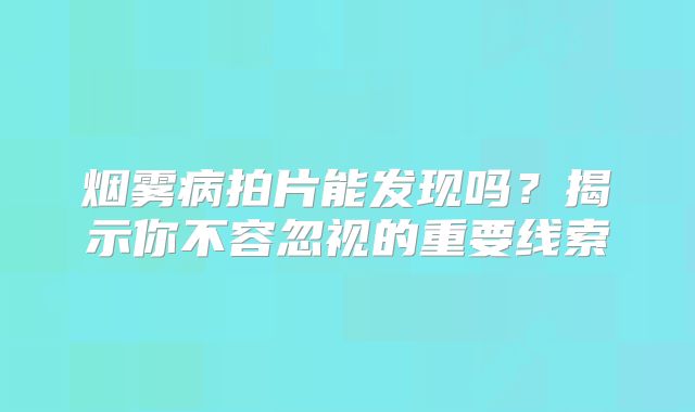 烟雾病拍片能发现吗？揭示你不容忽视的重要线索