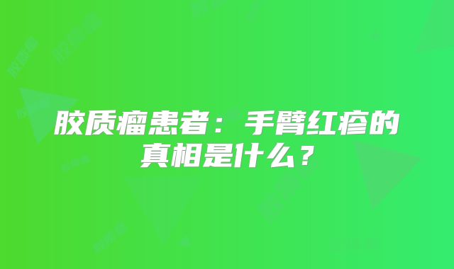 胶质瘤患者：手臂红疹的真相是什么？