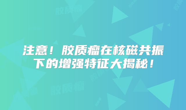 注意！胶质瘤在核磁共振下的增强特征大揭秘！