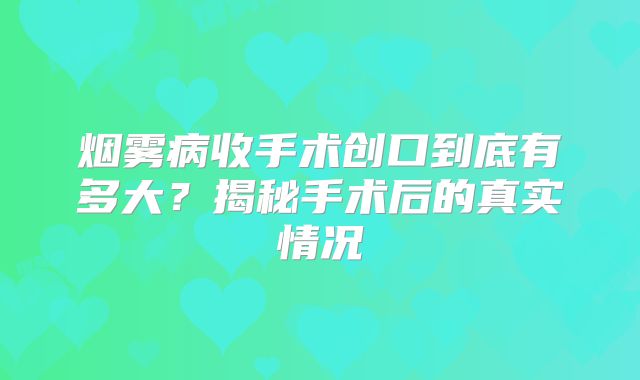 烟雾病收手术创口到底有多大？揭秘手术后的真实情况