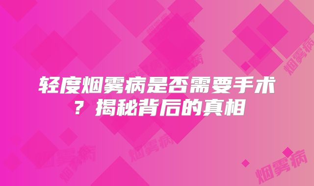 轻度烟雾病是否需要手术？揭秘背后的真相