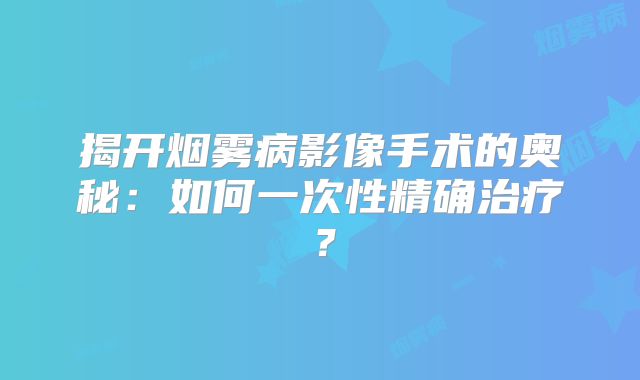 揭开烟雾病影像手术的奥秘：如何一次性精确治疗？